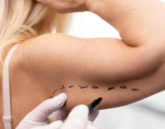 Брахиопластика 